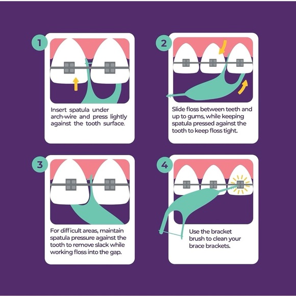 Platypus Orthodontic Flossers for Braces, 30 Count (Pack of 4) - Picture 3 of 5